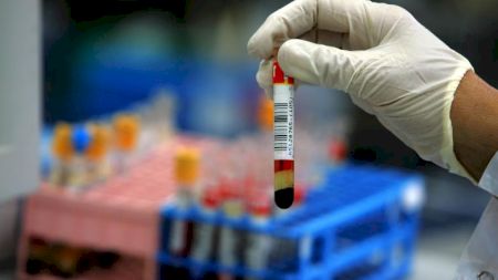 Epidemia momentului a ucis deja 6.000 de oameni! Este prezentă și în România