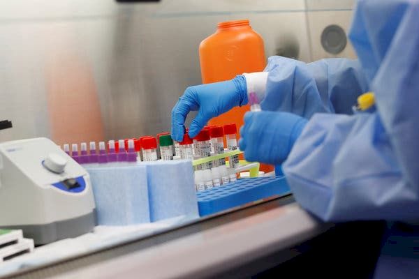 Legătura dintre produse lactate și COVID-19 ? Descoperire revoluționară a cercetătorilor