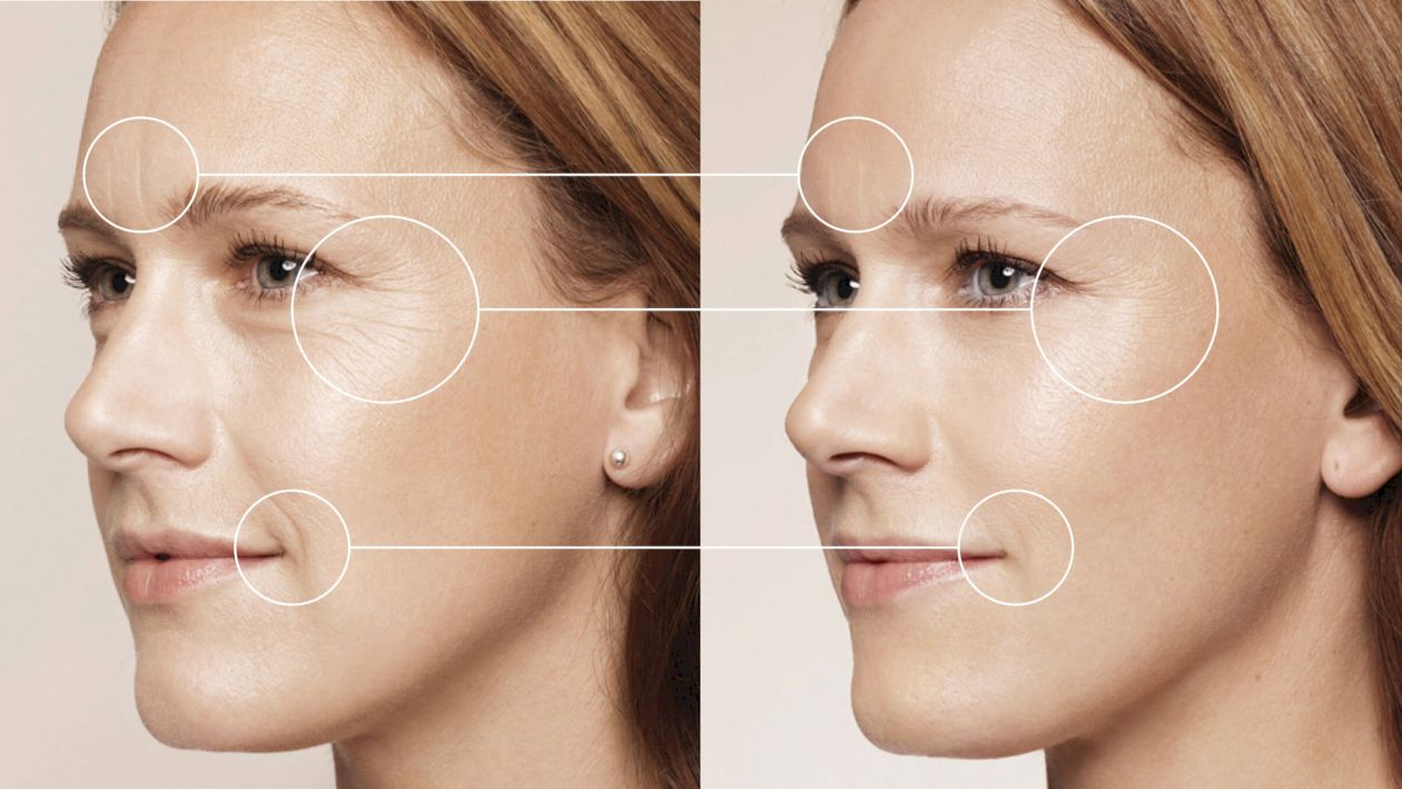 Scapă de riduri și reduce-ți porii! Top măsuri pe care trebuie să le aplici