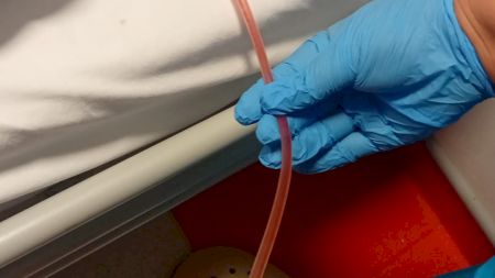Semnal de alarmă de la medici: simptomul care apare fără durere și poate ascunde o boală gravă. Mulți români îl ignoră